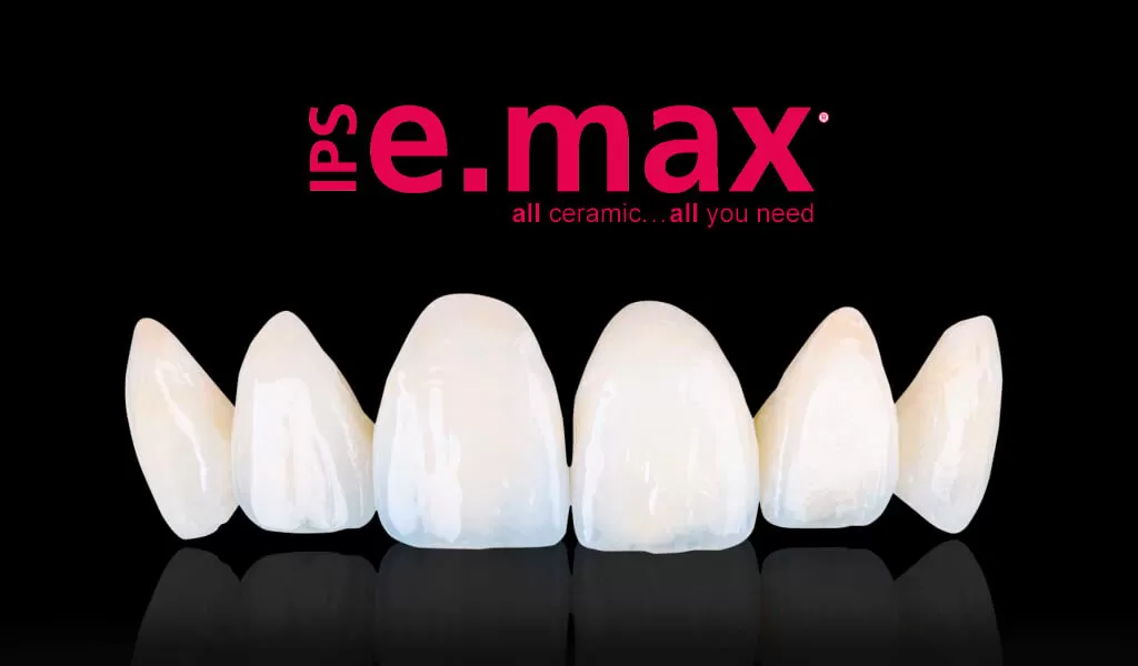 Виниры e.max